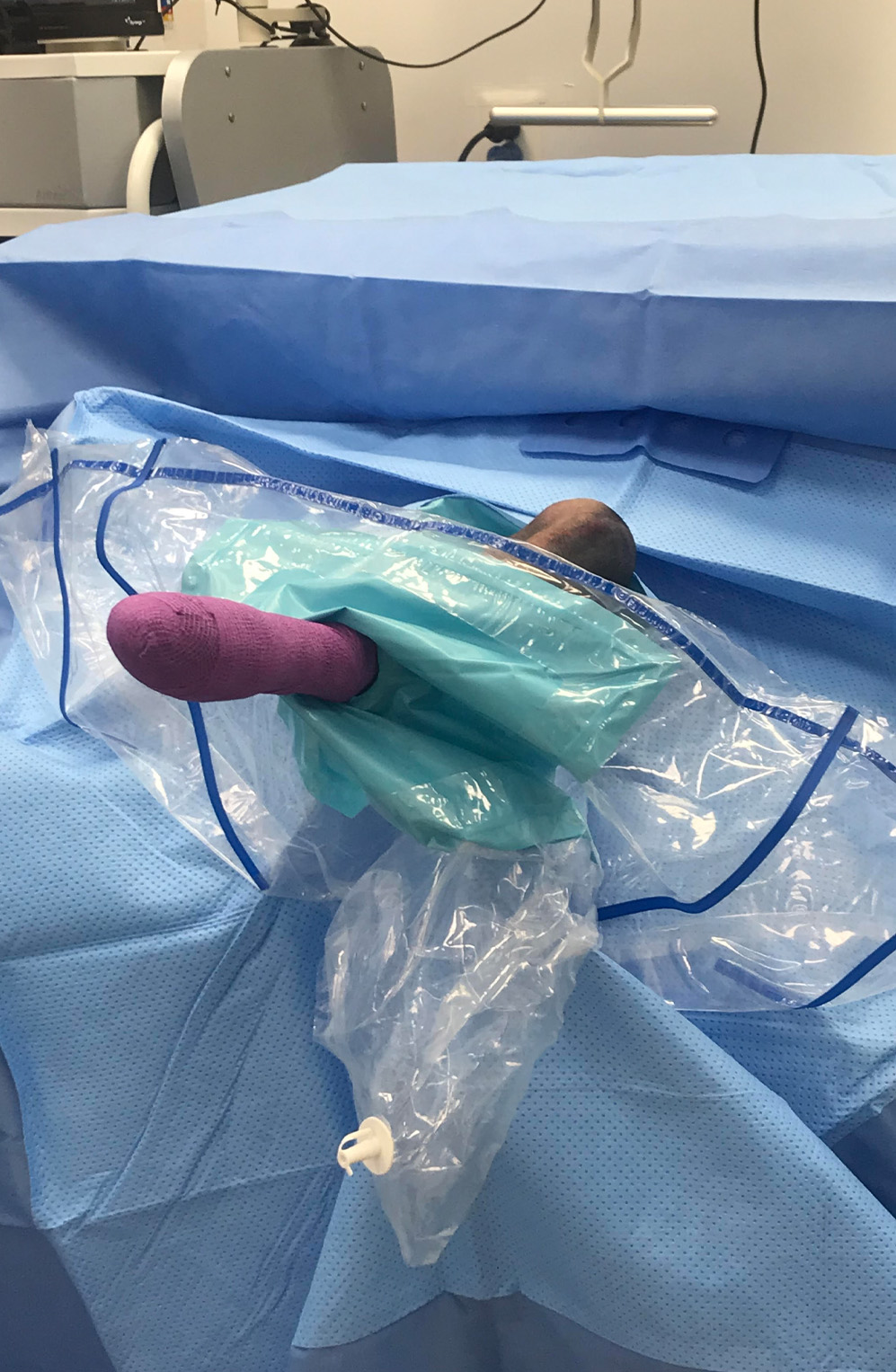 Bilateral knee drape from AHS