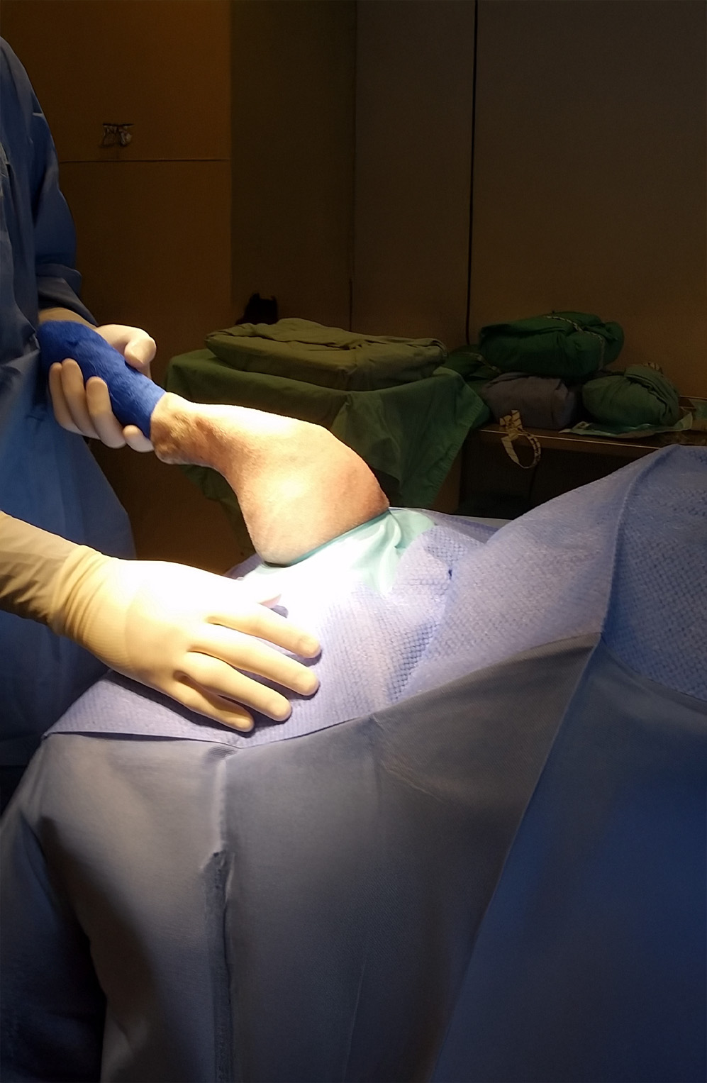 Bilateral knee drape from AHS